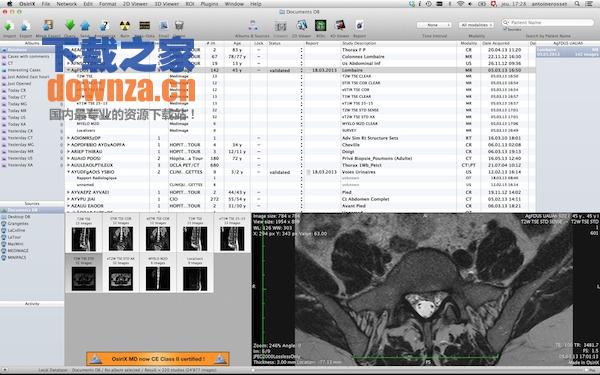 OsiriX for mac截图